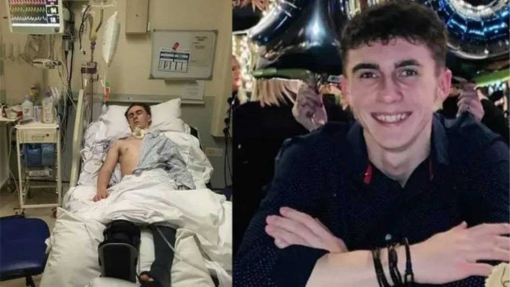 adolescente-británico-coma-despierta-10-meses-pandemia-la-chiva-de-uraba