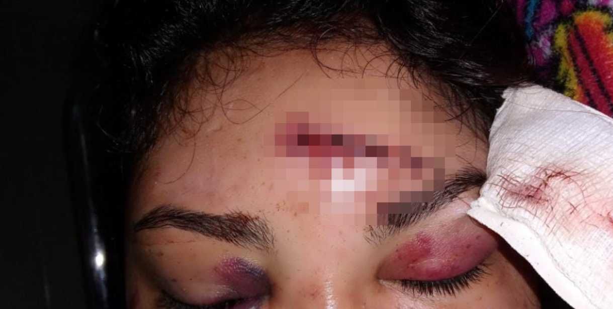 agresion-contra-la-mujer-la-chiva-de-uraba