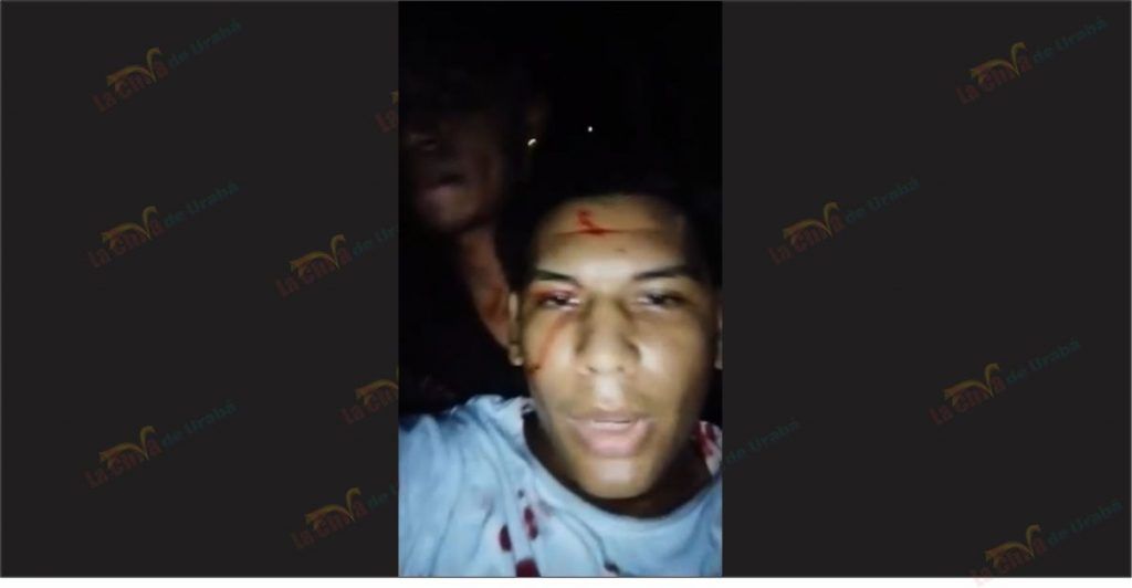 se-grabo-despues-de-ser-herido-la-chiva-de-uraba